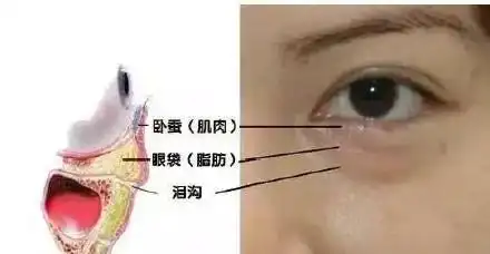 萎缩,眼下的结缔组织发生水肿,均可造成眼袋