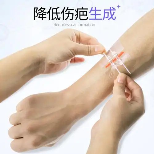 医用拉链式创口贴免缝胶带皮肤伤口减张贴无创拉合缝合贴免缝针器