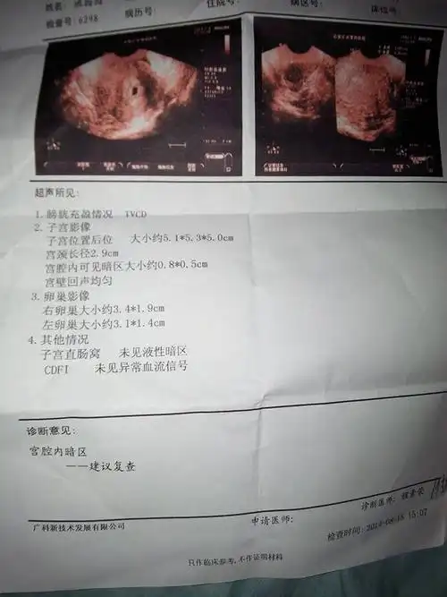 五周零三天,做的阴彩超,能看出来胎心和胎芽吗?