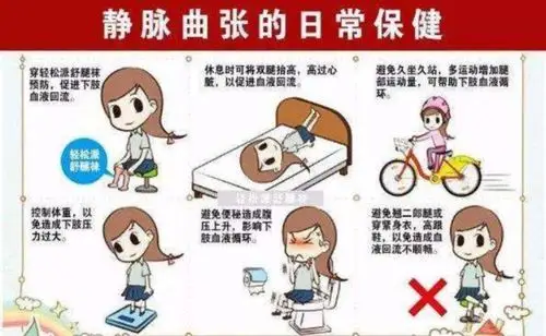 我科常规开展"硬化剂注射治疗下肢静脉曲张"