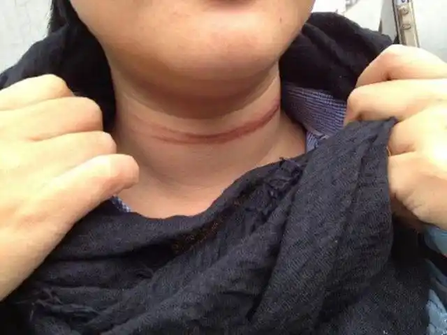 骑电动车:围巾卷入车轮内将脖颈勒断"夺命围巾"你知道多少?