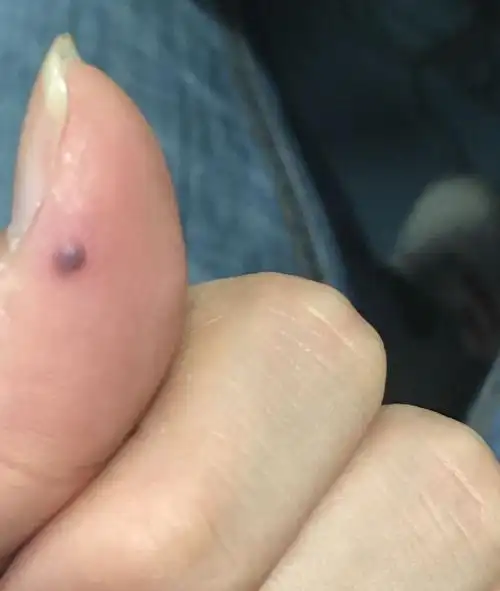 这个黑点是怎么回事