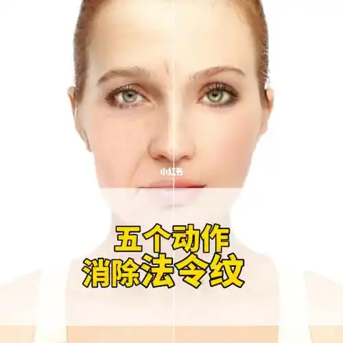 第48集五个动作消除法令纹