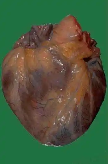 人的心脏长什么样子看图片