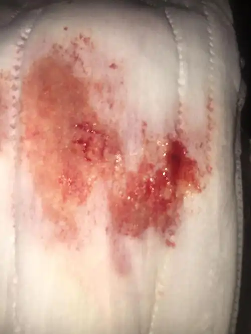 经血有白带吗粘粘的