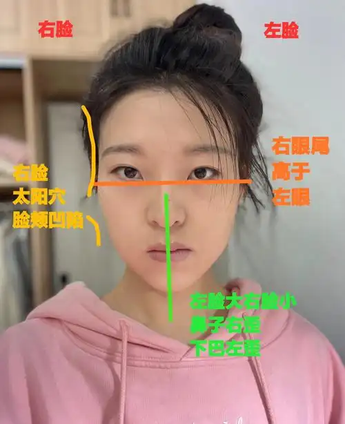 脸歪不对称的罪魁祸首是单侧咀嚼