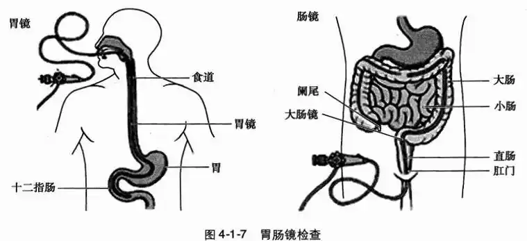 在胃肠镜检查时,可在严密的监护下,经静脉给予适量