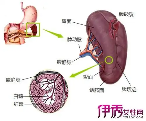 脾大是重要的病理体征.