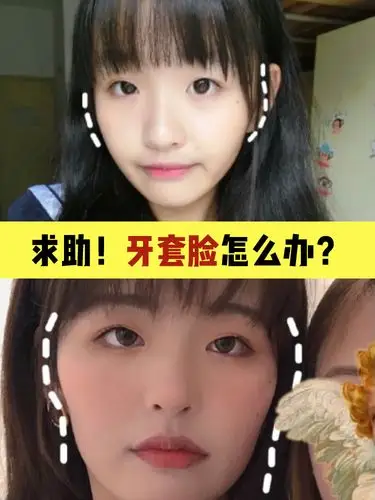 牙套脸真的没法救了吗?