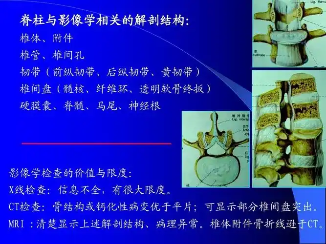 后纵韧带,黄韧带) 椎间盘(髓核,纤维环,透明软骨终扳) 硬膜囊,脊髓