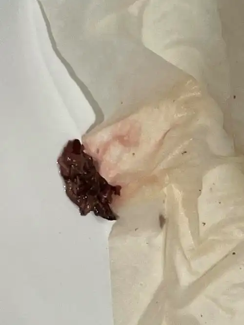 来姨妈期间这是霉菌吗有图慎慎慎慎入