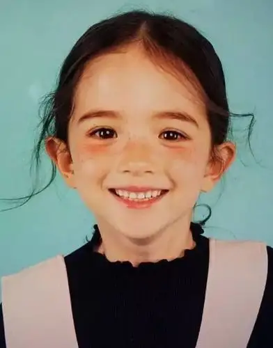 宝宝牙齿不整齐,是小时候矫正呢?还是长大后?-洪慈忆主治医师-爱问医