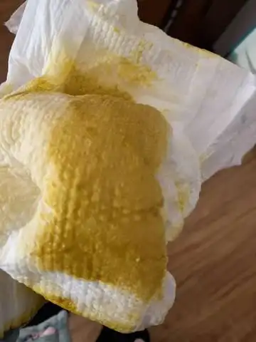 每次拉到衣服上