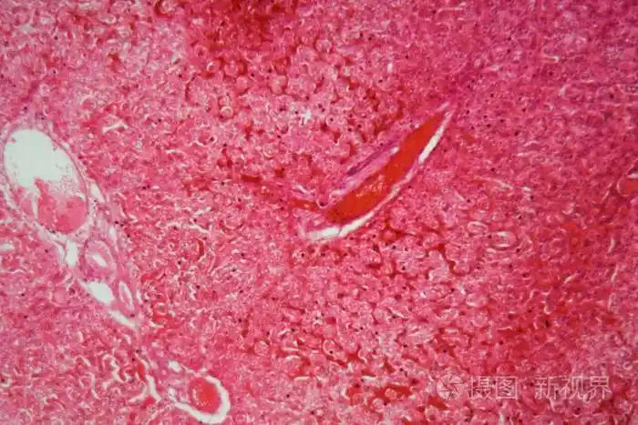 显微镜下的肝细胞