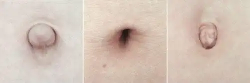 2013年同龄圈 21 0,婆婆说我现在的肚子和她快生的时候差不多~ 肚脐