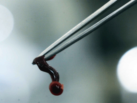 这条水蛭长约2厘米,还有吸盘,因此取出比较困难.