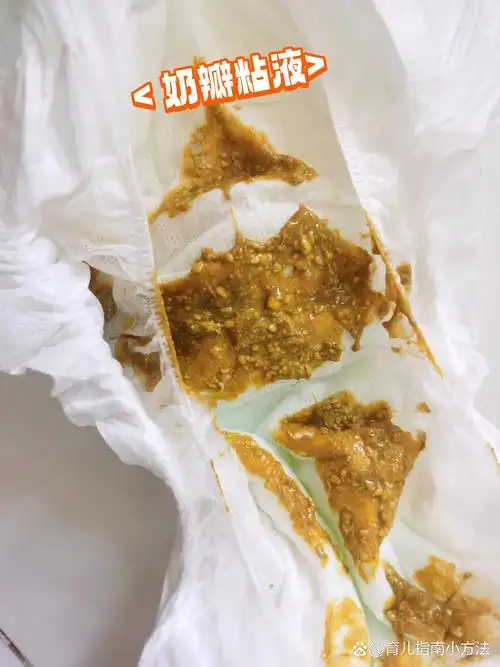 宝宝奶瓣粘液便 to 正常便便(内有93图) 首先说下宝宝乳糖不耐的