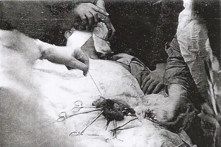 当时的九州帝国大学医学部正在展开一场匪夷所思的实验,为了弥补战场