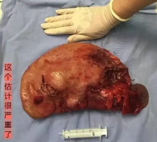 不点进来就发脾气了啊