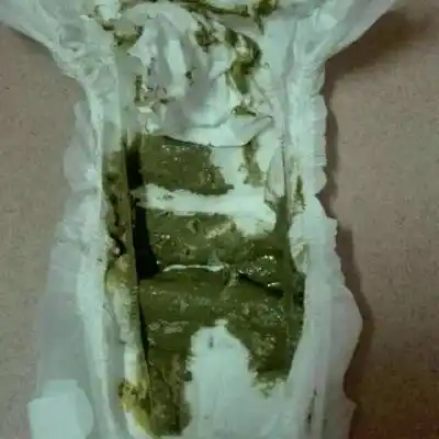 吃奶粉,两天不拉屎,前两天就喂有两次冲剂,突然拉屎是墨绿色的怎麼办?