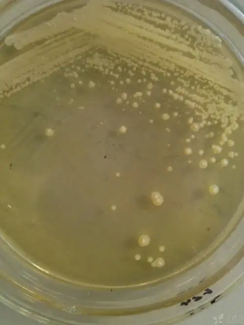 菌落有乳白色的顶突,整个菌落是很明显的突起
