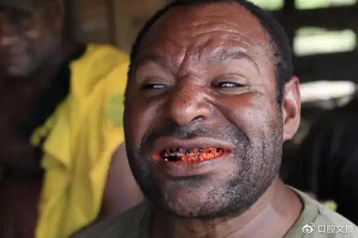 我是口腔医生我真心希望大家千万不要再吃槟榔了