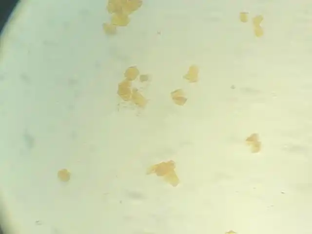 显微镜下的人体口腔上皮细胞,叶横切临时装片,鸡蛋结构