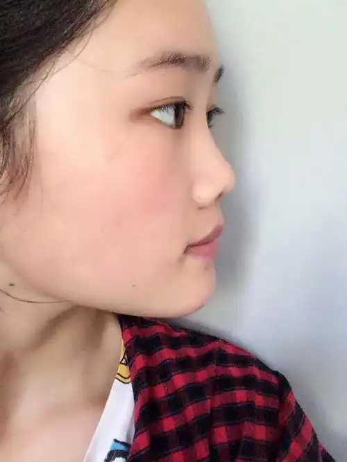 鼻梁塌陷面相代表了什么运势