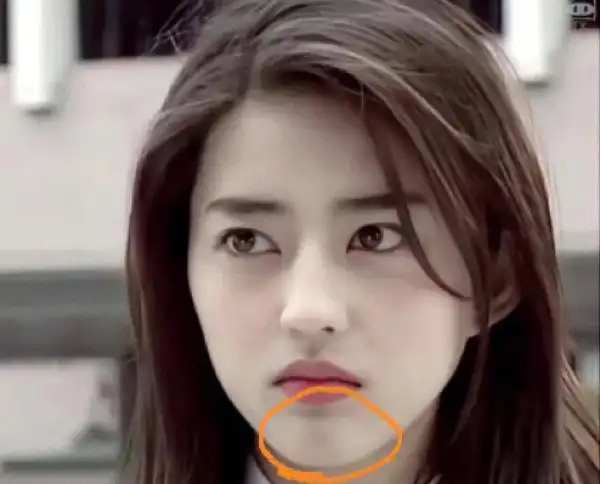 有姐妹知道下巴这道痕学名叫啥