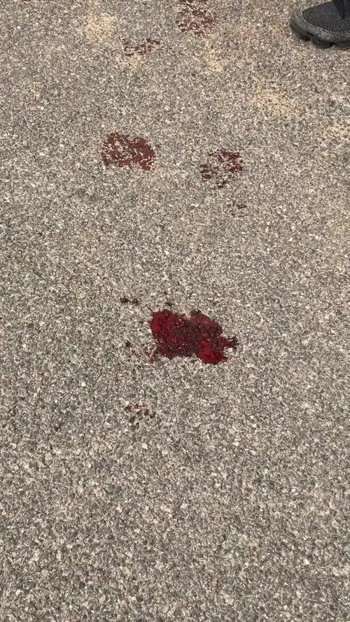 前挡风玻璃凹陷,地上留下一滩血.