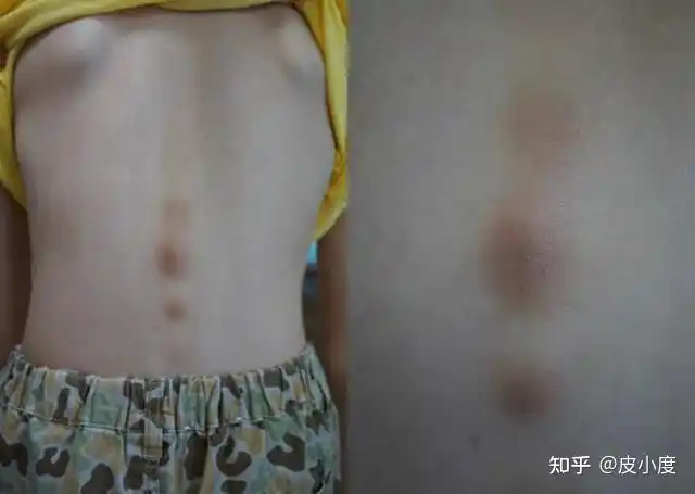 孩子皮肤变黑了这个原因你可能想不到