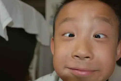 斗鸡眼我来示范最好了