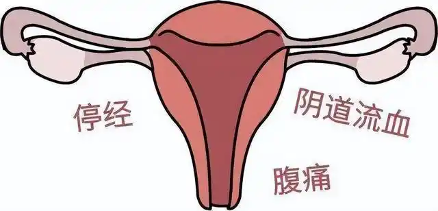 肿瘤,内分泌失调和月经排卵的失调,也很有可能是宫颈炎及宫颈糜烂,也