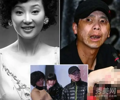 美女嫁丑男 9对明星夫妻容貌惊悚对比_美容护肤知识大全_百度攻略