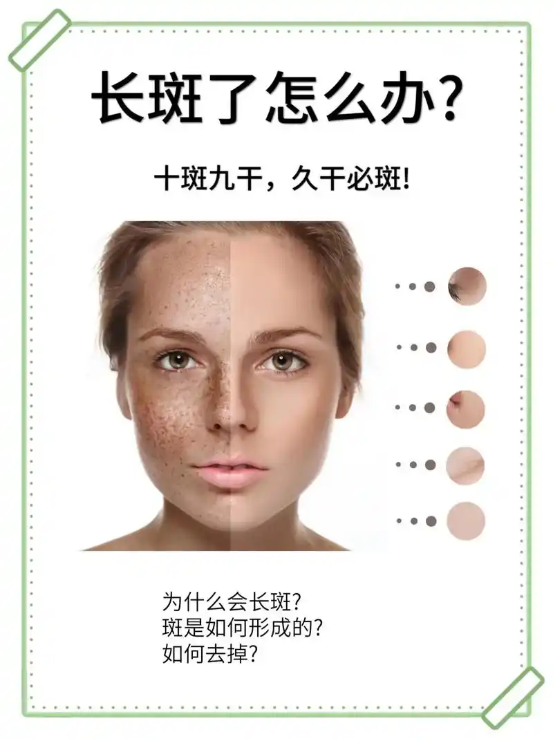 拒绝脸上长斑!有斑的姐妹看过来.十斑九干,久干必斑 - 抖音