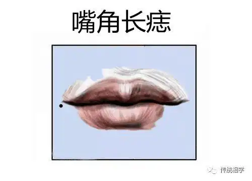 男人也有克妻痣,好吃懒做,不赚钱养家,烂桃花不断!