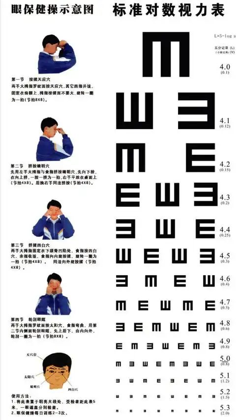 展开全部 200°左右的近视.