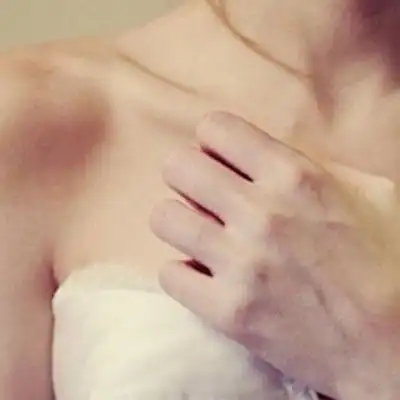 乳房长出酒窝来忽视不得 小心演变成癌症!