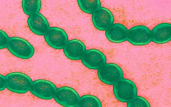 肺炎链球菌肺炎病理分期