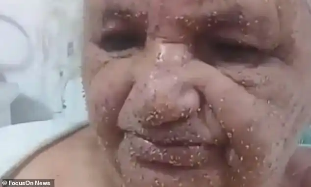 惨不忍睹巴西老妇人垂钓惊动蜂窝被万只蜜蜂围攻脸上全是刺