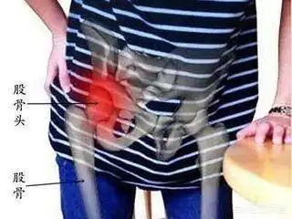 大腿根部疼多是得病了大腿根部疼的四种原因很多人不知道