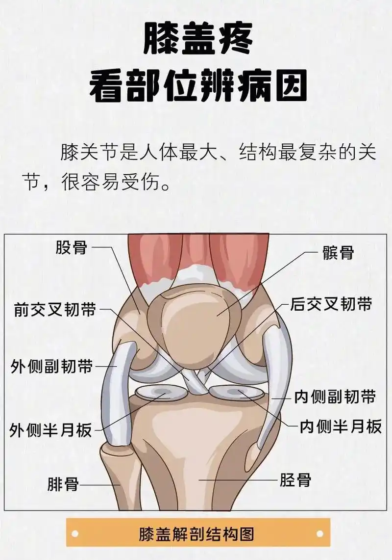 膝盖疼痛位置对照表,看清膝盖疼到底是哪里的病? - 抖音