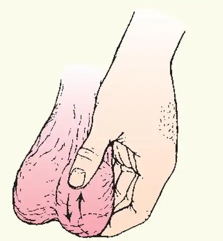 5种睾丸癌的早期症状,每个月都应该这样自查一次