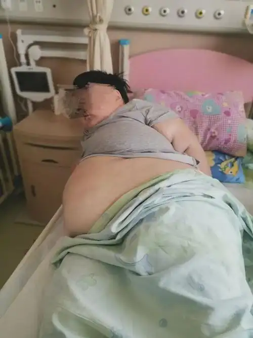 肚子里还掏出了奶嘴?|高血压|肥胖症|高血脂|暴饮暴_网易订阅