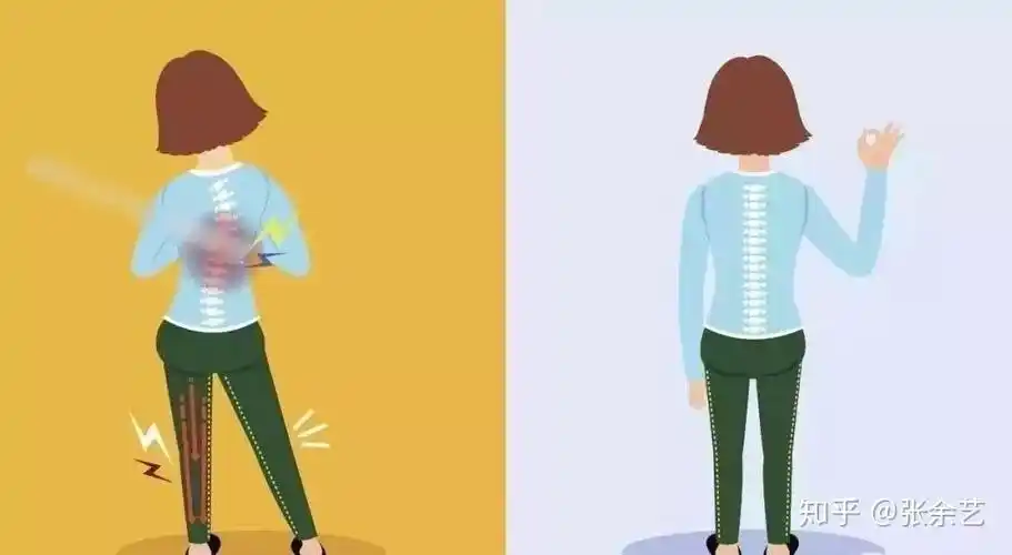 不良站姿及跑步姿势会加重某些肌肉的紧张度,时间久了,不仅使肌肉僵硬