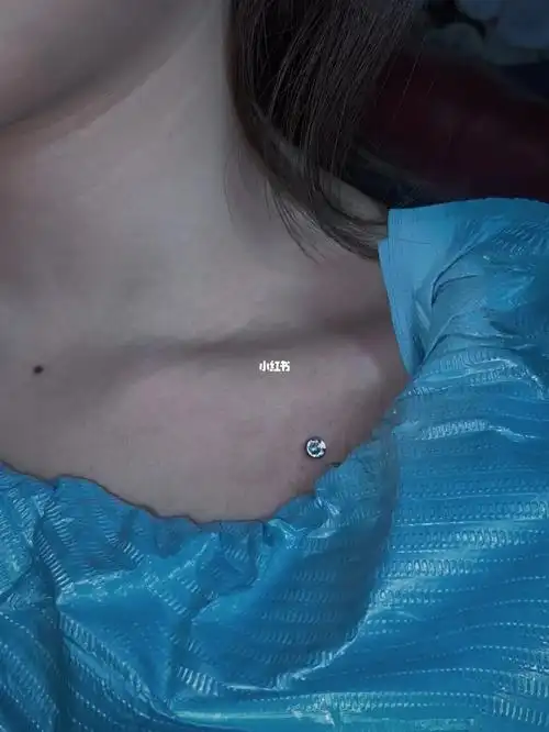 南昌穿孔南昌埋钉锁骨埋钉