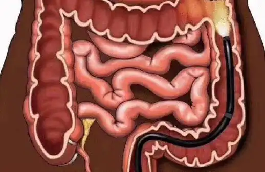 大便的时候,前面很硬,后面很软,说明什么问题?