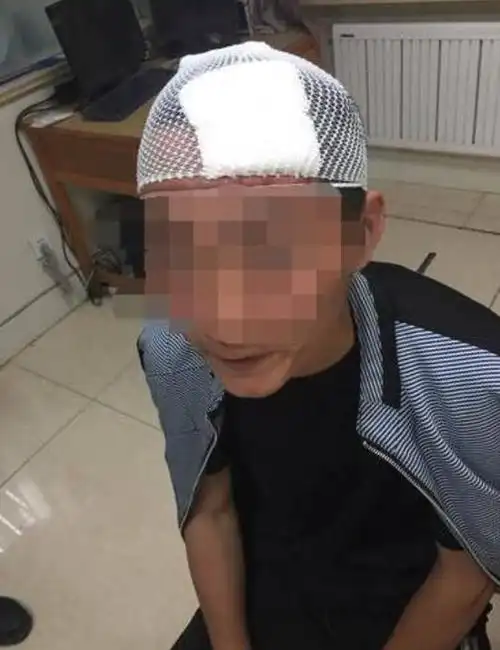 团伙拦路抢劫打伤6名民警 声称打的就是警察