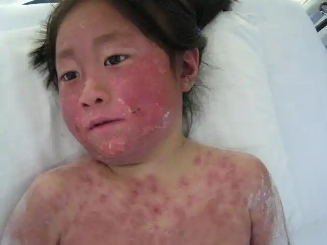 【分享】3张典型疾病照片