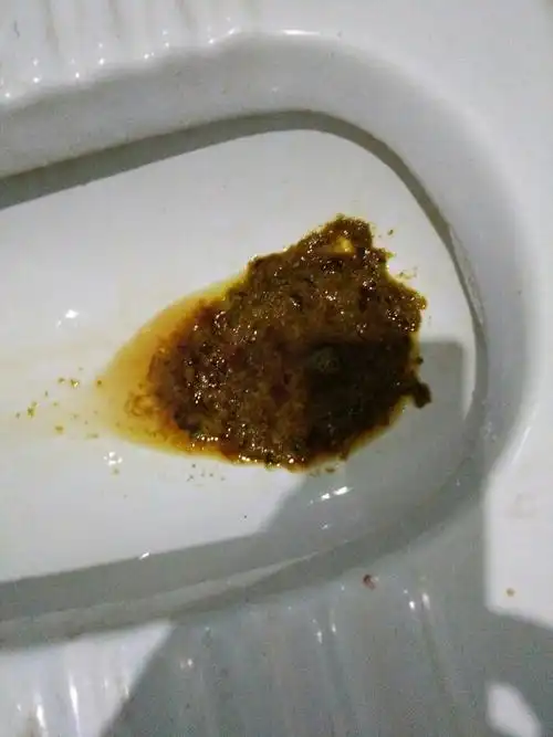 不知道什么原因导致的,在十分钟内拉了三次这样的大